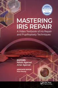 Mastering Iris Repair A Video Textbook of Iris Repair and Pupilloplasty Techniques